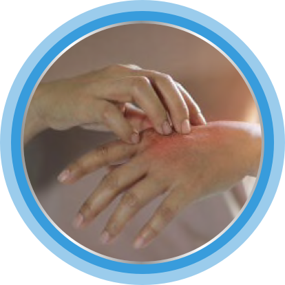 Bepanten – dermatitda yordam